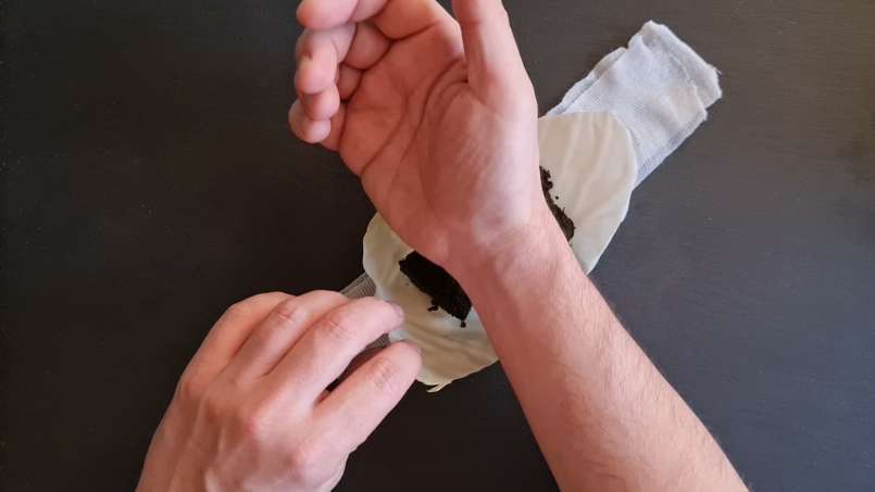 Brennnesselumschlag bei Rheumatismus, foto 6