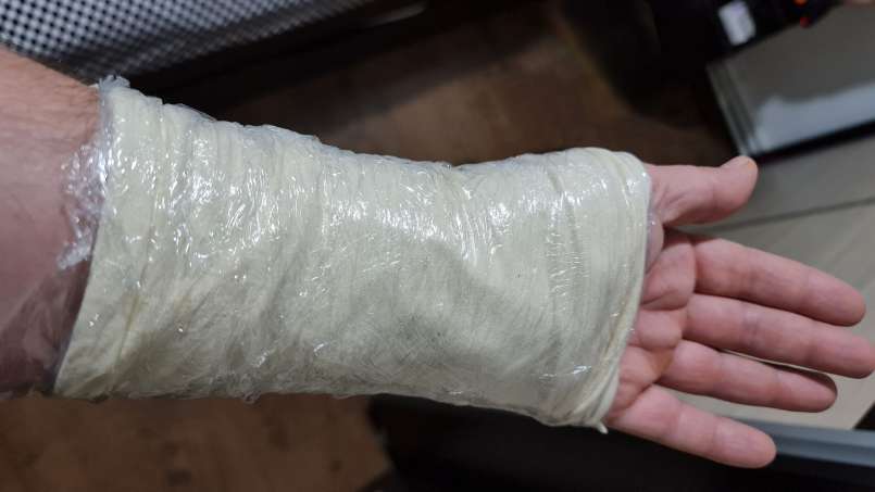 Breiumschlag mit Laugen und Kohlblättern, foto 8